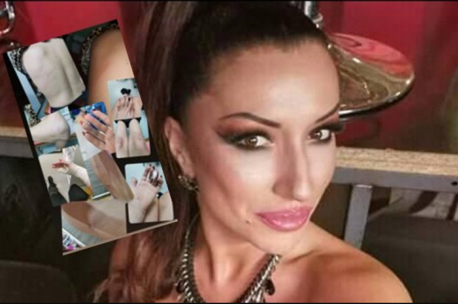 ŽIVI U STRAHU Pretučena Zvezda Granda i dalje loše: Zatvorila sam se i trpim užasne bolove