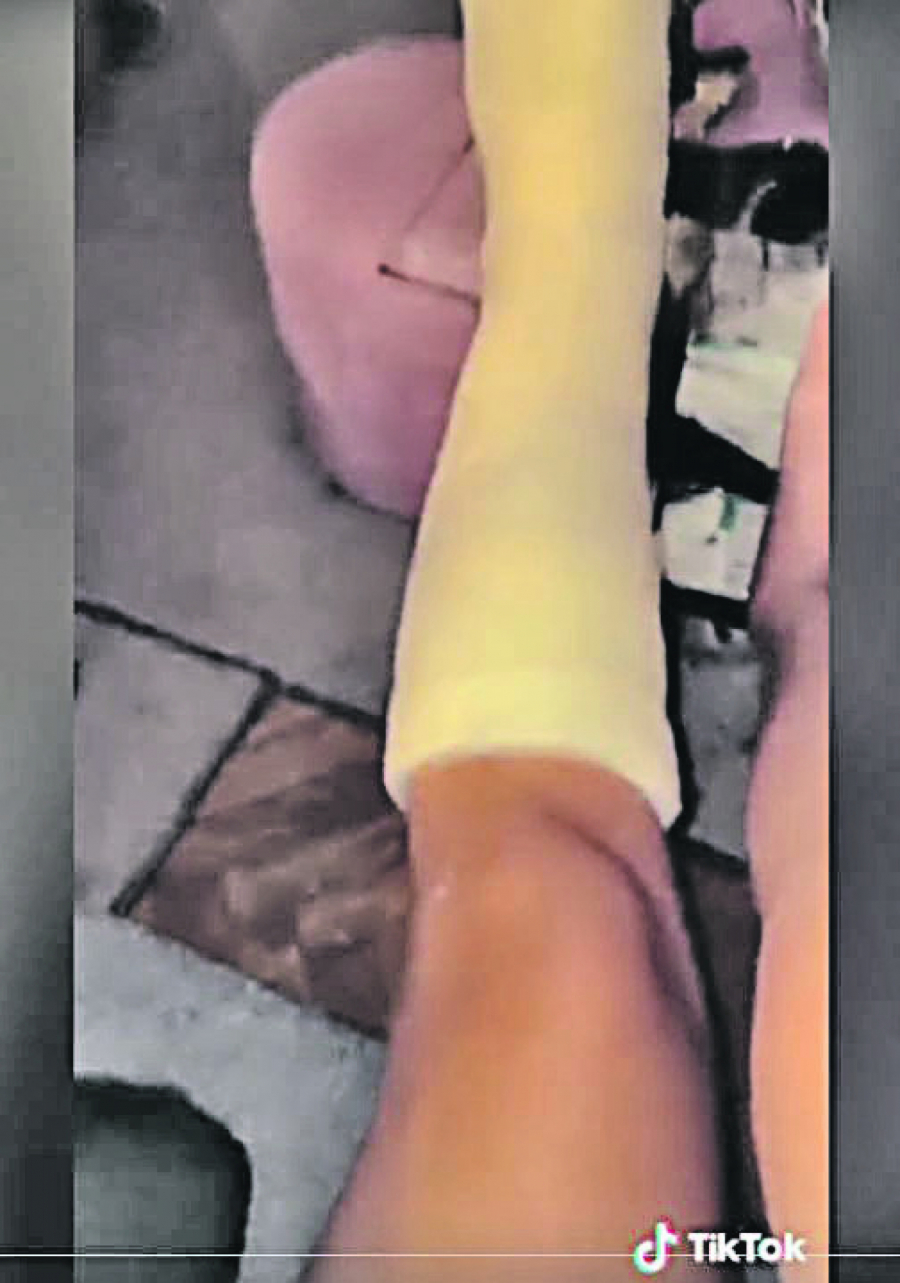 SANDRA REŠIĆ OGLASILA SE NAKON SAOBRAĆAJNE NESREĆE: Na posmatranju sam zbog vrtoglavica