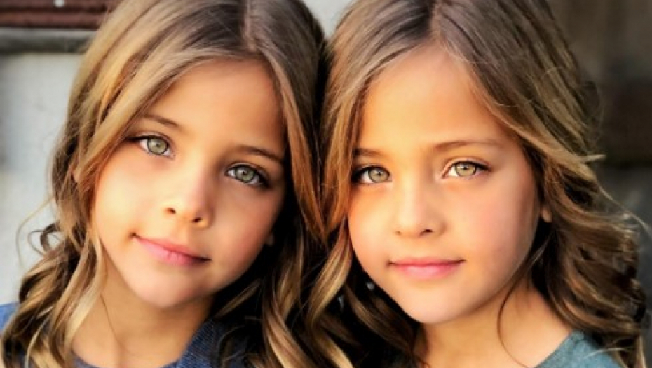PROGLAŠENE SU ZA NAJLEPŠE BLIZNAKINJE SVETA Evo kako danas izgledaju ove devojčice