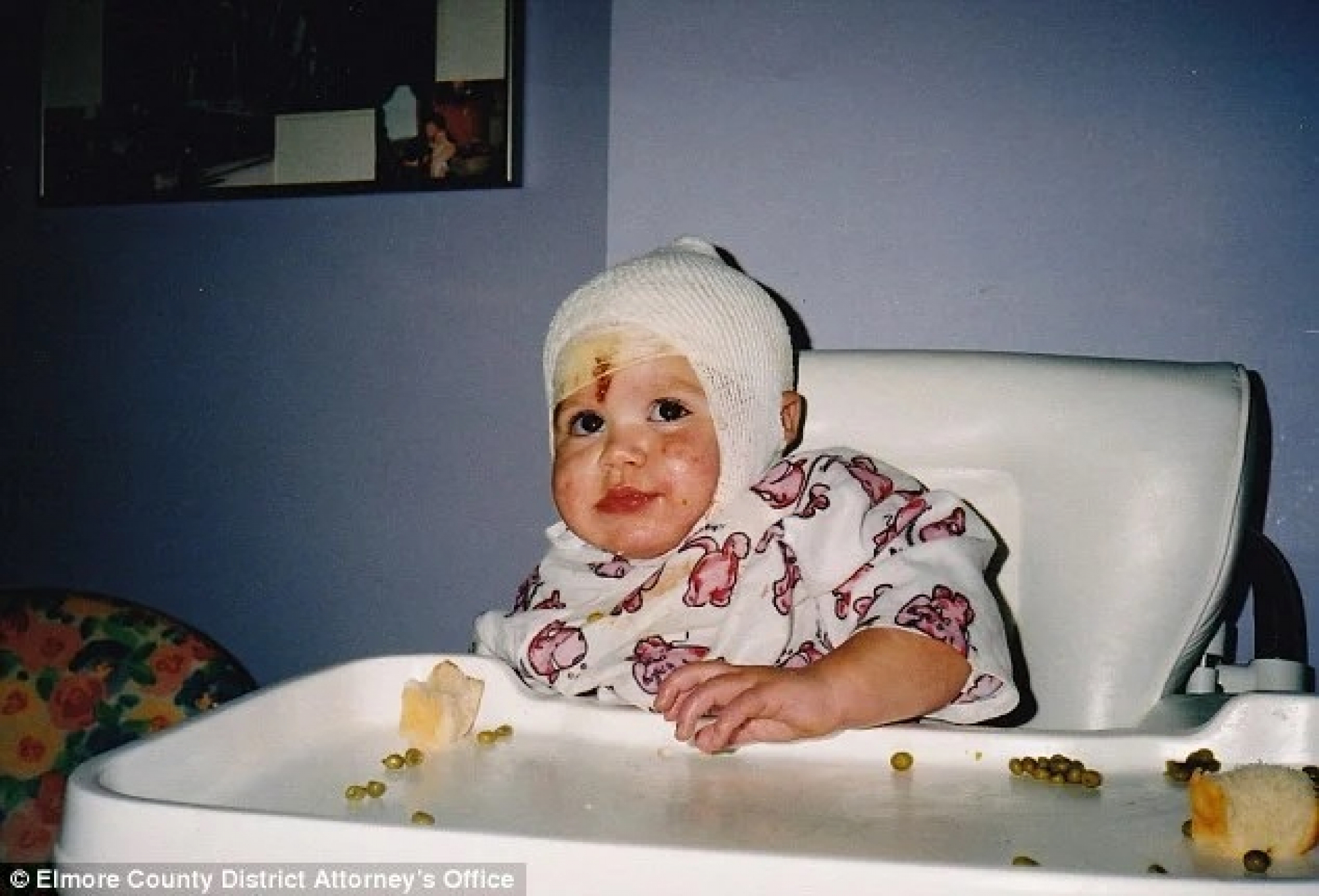 MAJKA STAVILA BEBU U VRELU RERNU Spasao je otac, evo kako danas posle brojnih operacija izgleda nesrećna devojčica