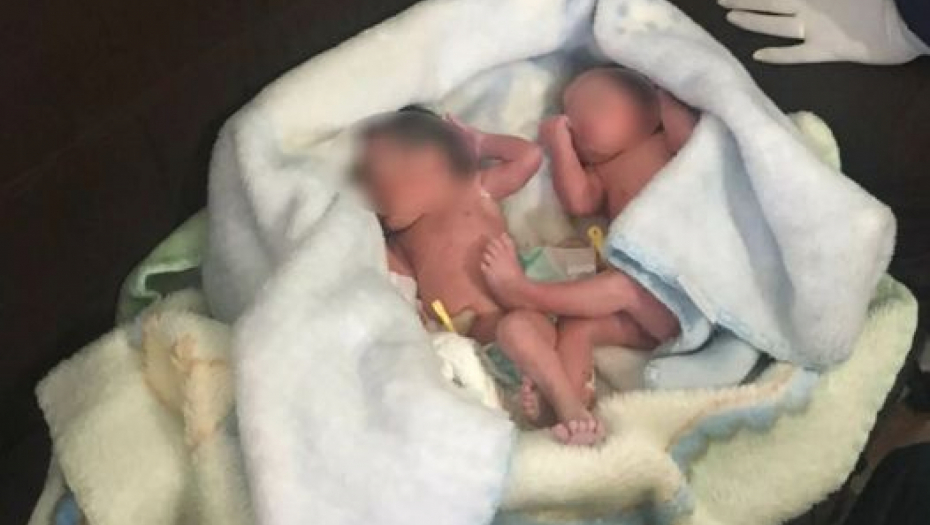 OČEKIVALE SU ŠTENAD Kad su se žene približela žbunju, otkrile su jezivu istinu