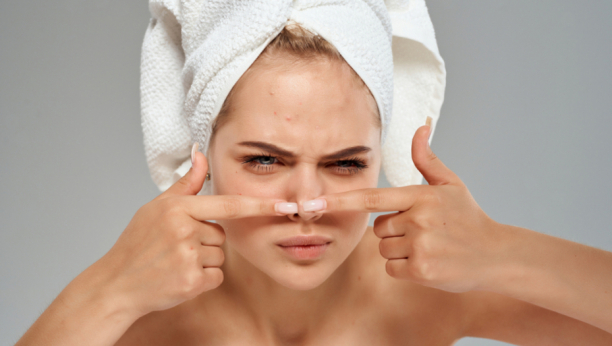 "TROUGAO SMRTI" NA LICU Stiskanje bubuljica može imati koban kraj