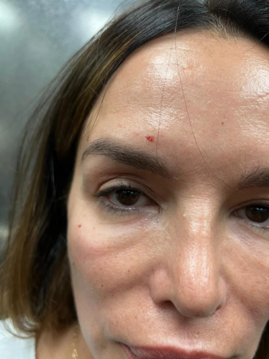 SEVERINA U BOLNICI U ZAGREBU Pevačica odvedena u ustanovu u pratnji policije