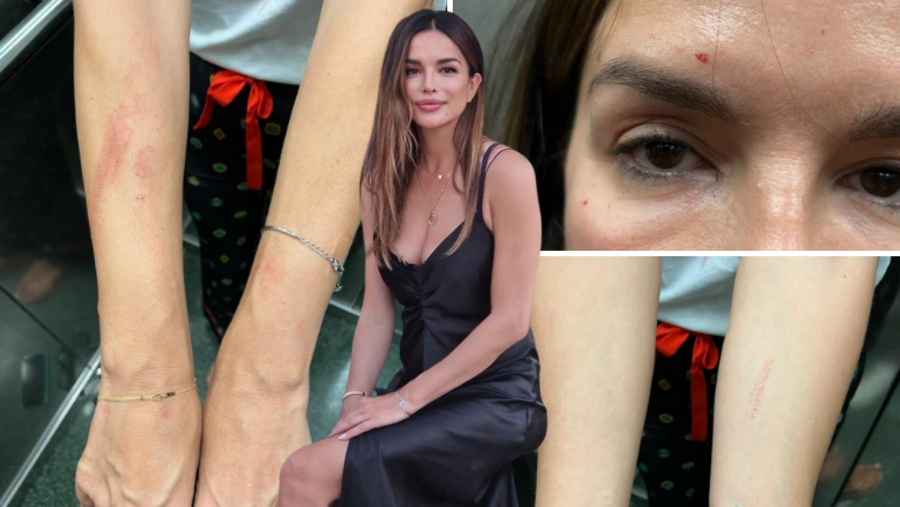 OVO JE ĆERKA SEVERININE SESTRE MARIJANE Mia tetku obožava, a u lošim odnosima je sa majkom (FOTO)