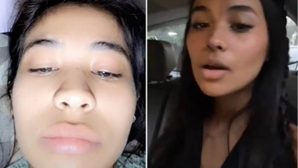 NOVA PRIRODNA TEHNIKA ZA SMANJENJE NOSA ZALUDELA JE CEO SVET Mnogi tvrde provereno radi dok drugi sumnjaju