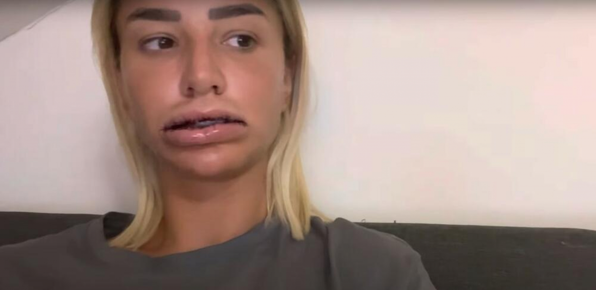 SILIKONI IM DOŠLI GLAVE Ove javne ličnosti su otišle na operaciju, pa su imale velike probleme