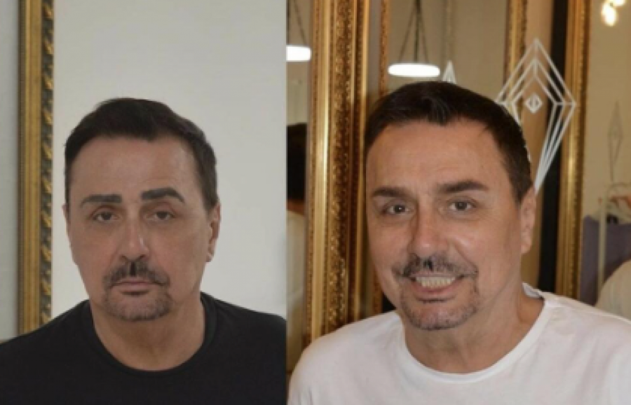 KEBA TRI PUTA IŠAO NA REMONT OBRVA Pevač vodi računa da uvek izleda tip-top, a evo kako on komentariše svoju promenu (FOTO)