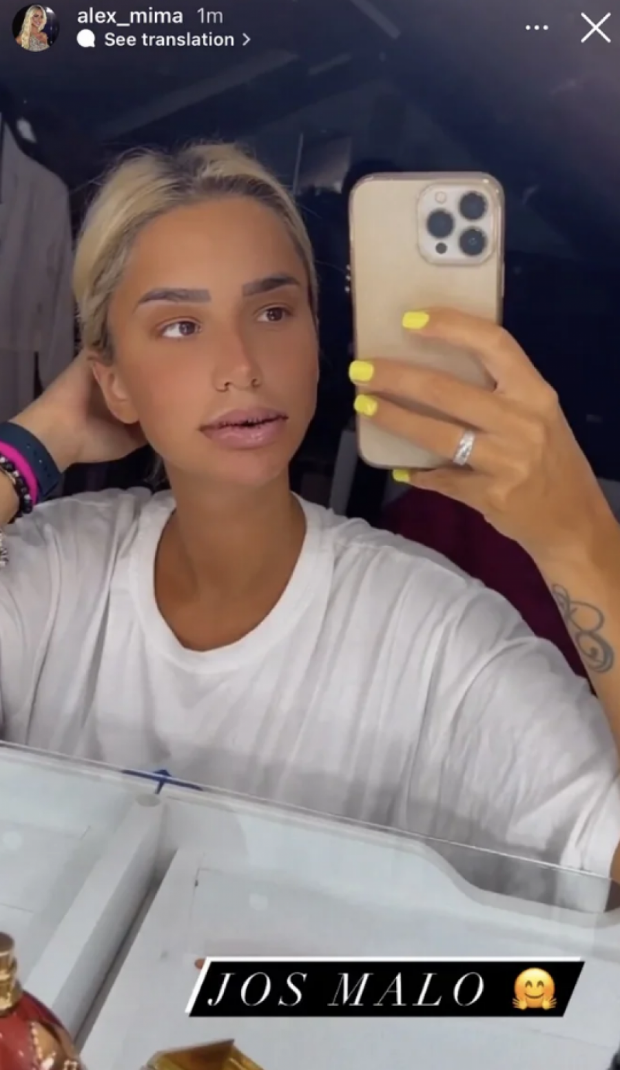 OTOK I CRNI KONCI Pre samo par dana izvadila silikon iz usana, a evo kako sad izgleda Aleksandra Nikolić (FOTO)