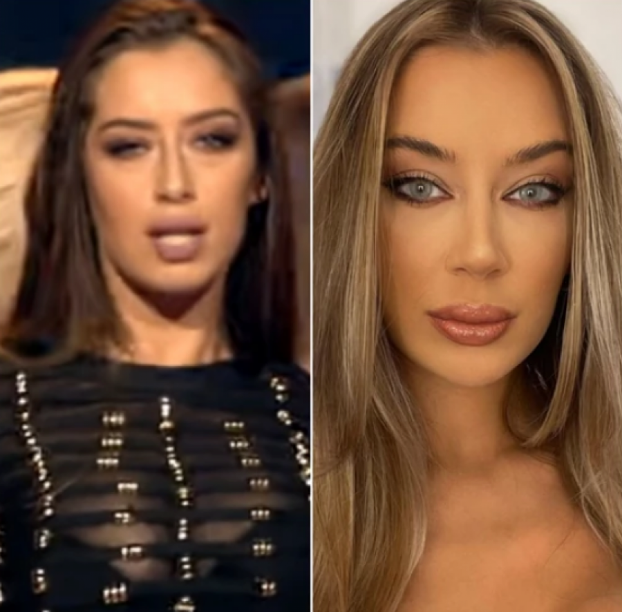 NAJVEĆE TRANSFORMACIJE NA ESTRADI Ne liče na sebe pre operacija, povećale grudi i usne, a ona se istopila