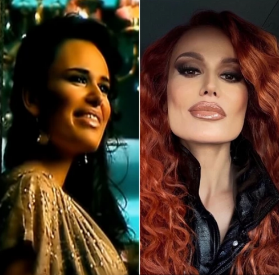 NAJVEĆE TRANSFORMACIJE NA ESTRADI Ne liče na sebe pre operacija, povećale grudi i usne, a ona se istopila