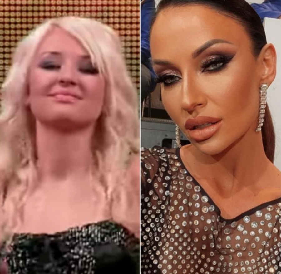 NAJVEĆE TRANSFORMACIJE NA ESTRADI Ne liče na sebe pre operacija, povećale grudi i usne, a ona se istopila