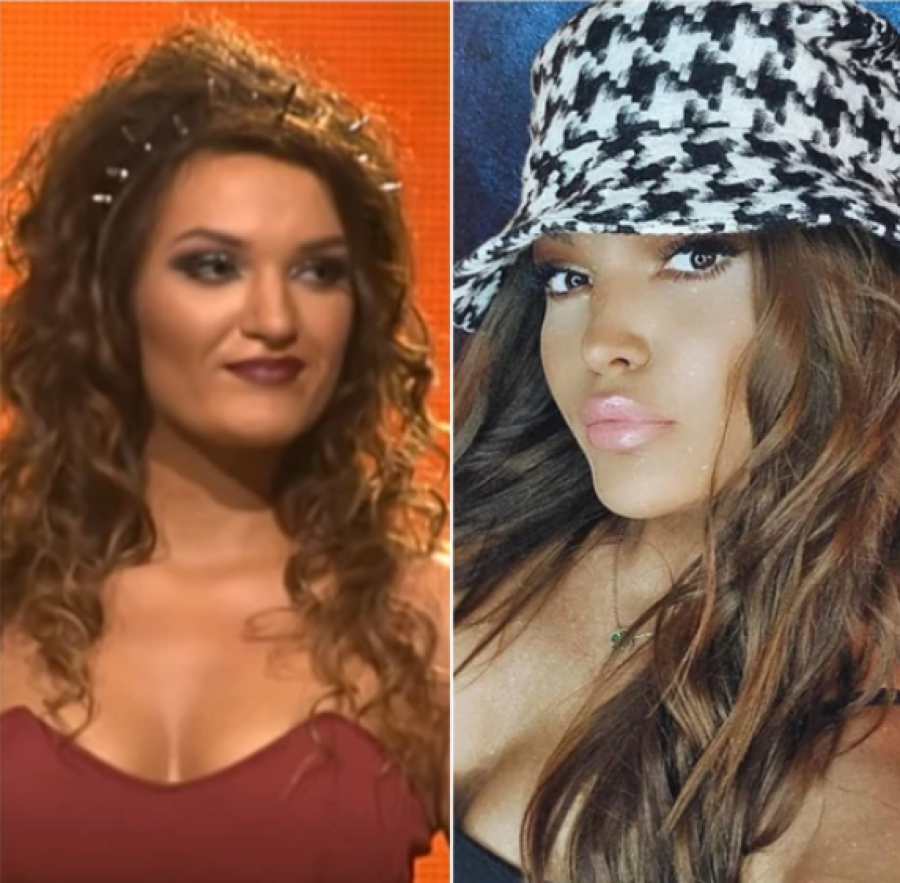 NAJVEĆE TRANSFORMACIJE NA ESTRADI Ne liče na sebe pre operacija, povećale grudi i usne, a ona se istopila