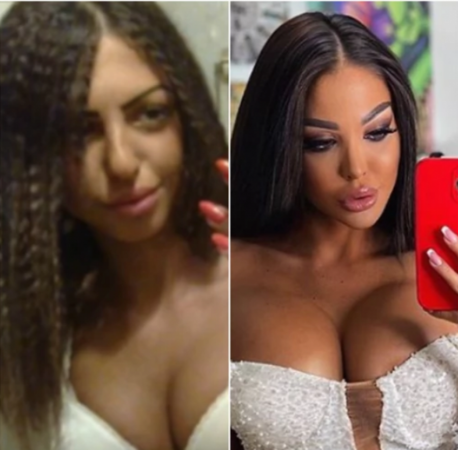 NAJVEĆE TRANSFORMACIJE NA ESTRADI Ne liče na sebe pre operacija, povećale grudi i usne, a ona se istopila