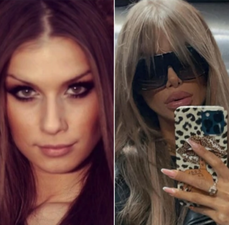 NAJVEĆE TRANSFORMACIJE NA ESTRADI Ne liče na sebe pre operacija, povećale grudi i usne, a ona se istopila