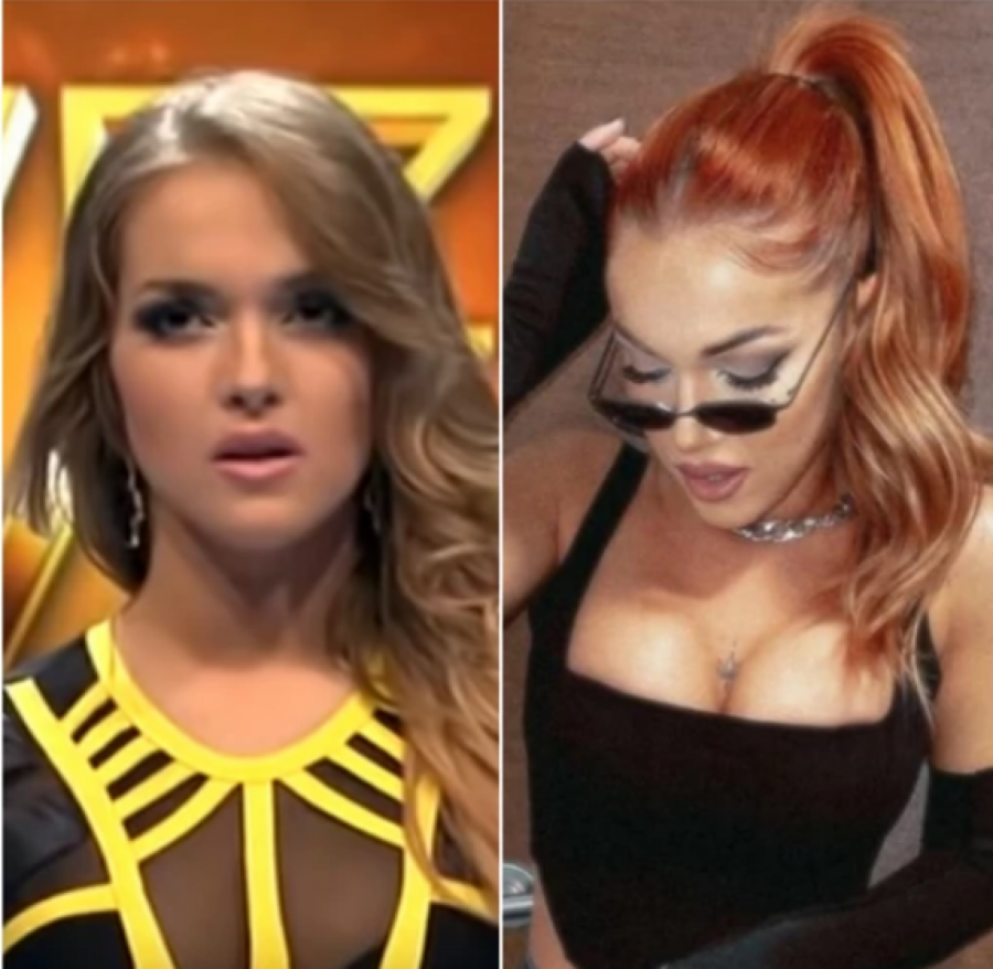 NAJVEĆE TRANSFORMACIJE NA ESTRADI Ne liče na sebe pre operacija, povećale grudi i usne, a ona se istopila