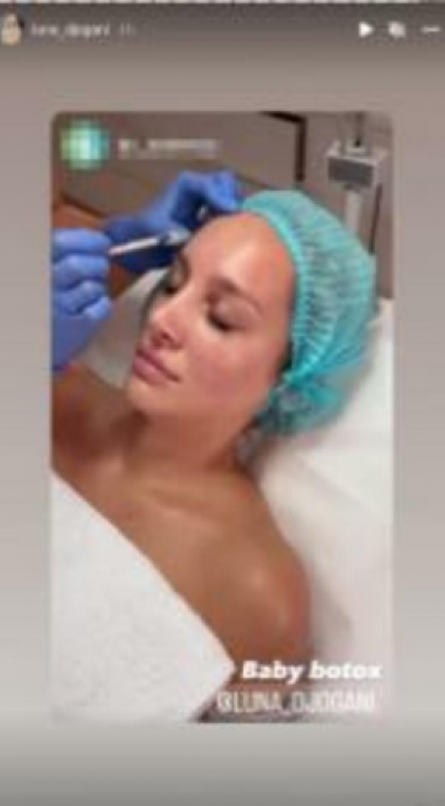 LUNA POKAZALA LICE Đoganijeva uradila ovaj estetski zahvat, pa se usnimila odmah nakon toga (VIDEO)