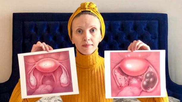 BORKA JE PRISTALA DA JOJ IZVADE UNUTRAŠNJE ORGANE: Otišla je kod lekara zbog bubrega, a dobila još strašniju dijagnozu koju ima svaka deseta žena u Srbiji