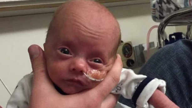 U 28. NEDELJI TRUDNOĆE SMRŠALA JE NA 40 KILOGRAMA: Rekli su joj da se ne nada da će dete preživeti, dečak je imao samo 1050 grama