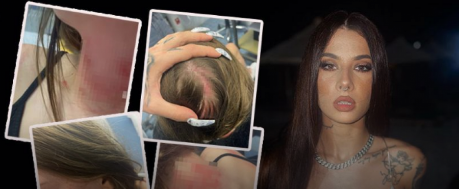 SARU SU BEZ GAĆA IZBACILI NA ULICU! Majka Uki Q za Alo! progovorila o nasilju koje je njena ćerka pretrpela