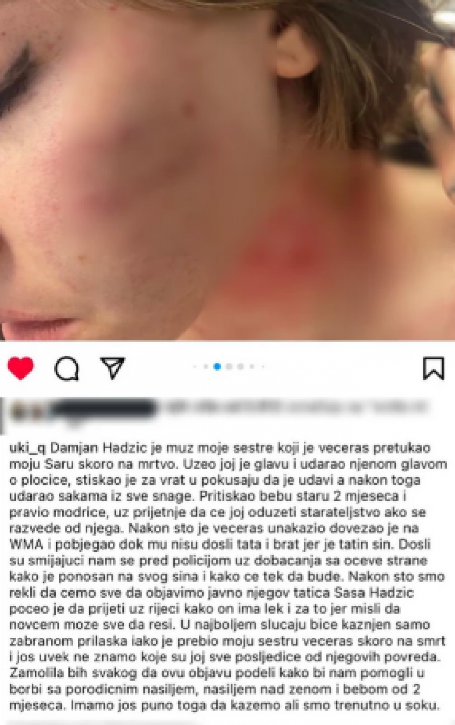 ISPOVEST PRETUČENE SESTRE TIKTOKERKE UKI Q Zbog muža plašim se sama da izađem na ulicu, a on još hoće sada da me tuži!