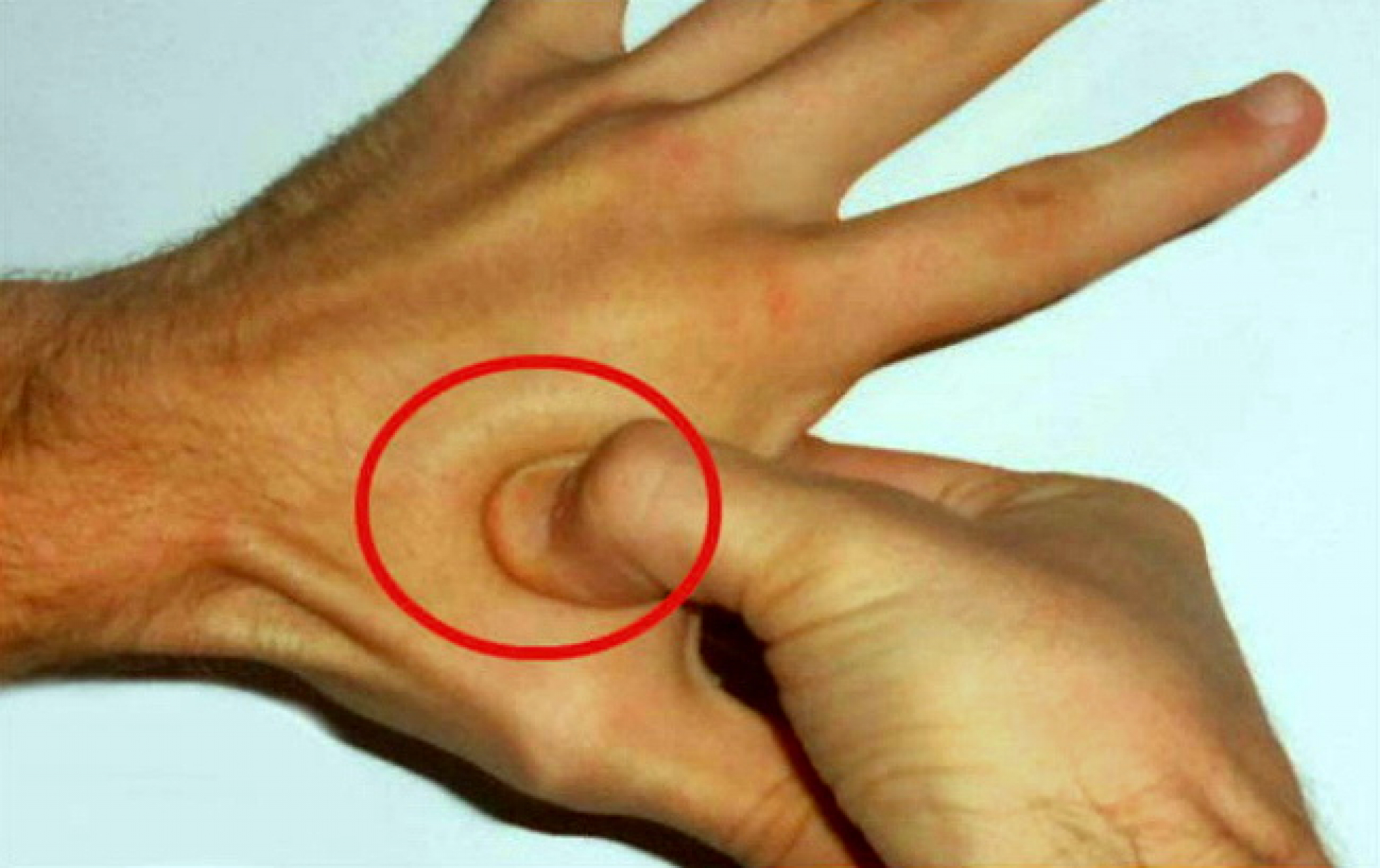 REŠITE SE STRESA I GLAVOBOLJE ZA POLA MINUTA Pritiskom na ovu tačku opustite nerve