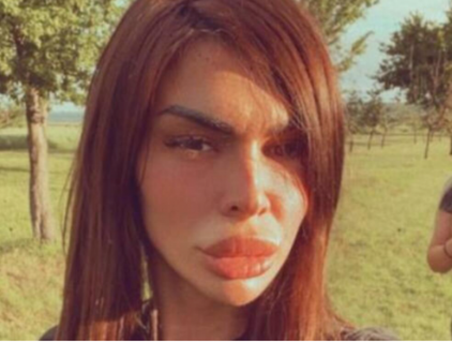 ŠOK! Kontroverzna učesnica iznela brutalne informacije o Aleks Nikolić: Videla sam šta radi kada je pod nedozvoljenim supstancama