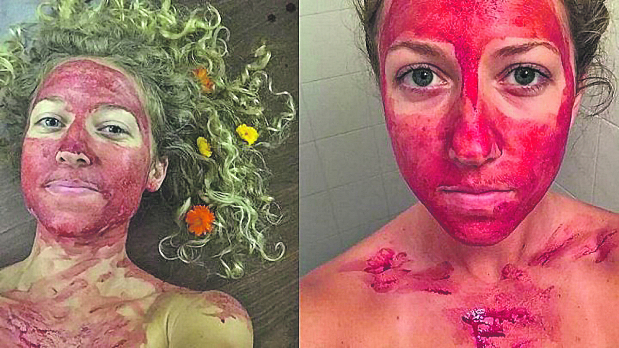 HIT NA DRUŠTVENIM MREŽAMA Menstrualna krv podmlađuje lice?