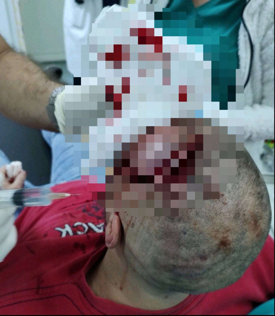 DETALJI MASOVNE TUČE U KIKINDI Delije stolicama i stolovima prebile obezbeđenje jer ih nisu pustili u kafić! (UZNEMIRUJUĆI SADRŽAJ)