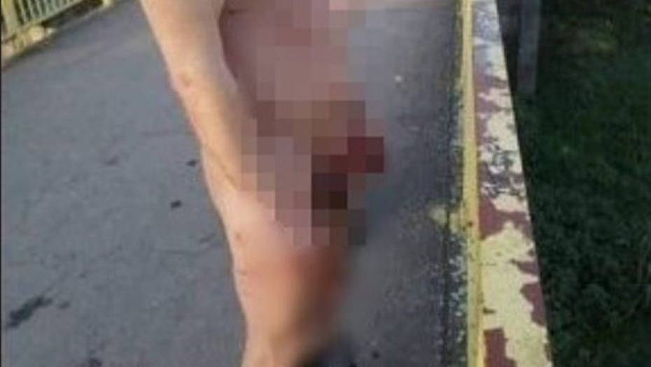 ODSEČENI POLNI ORGAN PERTLOM ZAKAČIO ZA MOST Otkriveno zašto je to uradio (FOTO)