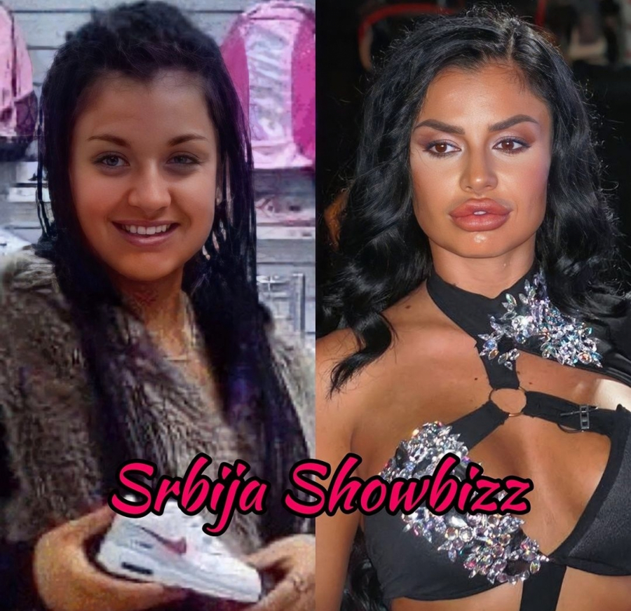 NEPREPOZNATLJIVA Evo kako je Sanja Grujić izgledala pre plastičnih operacija (FOTO)