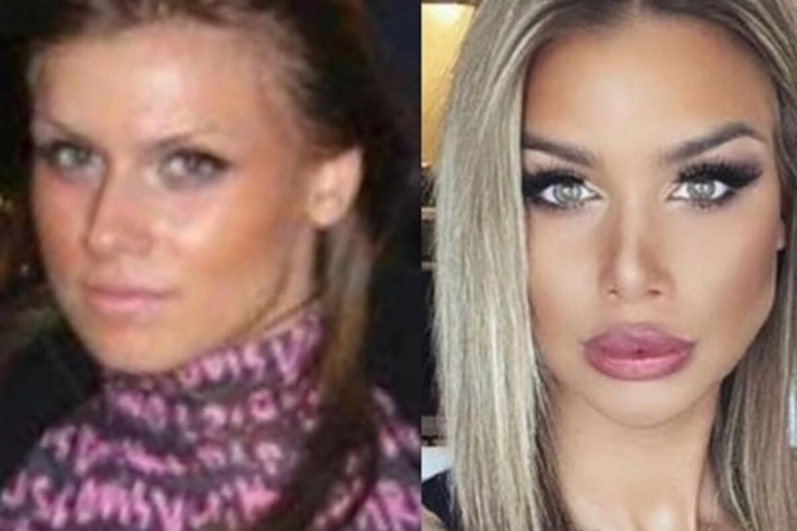 PROMENILA LIČNI OPIS Ivana Nikolić progovorila o estetskim operacijama, pa priznala koje je sve zahvate radila