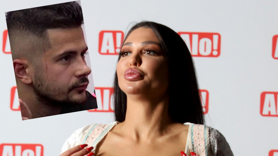 SRAM IH BILO Nakon što je Bilalov menadžer najavio da će tužiti Maju, oglasio se i Taki