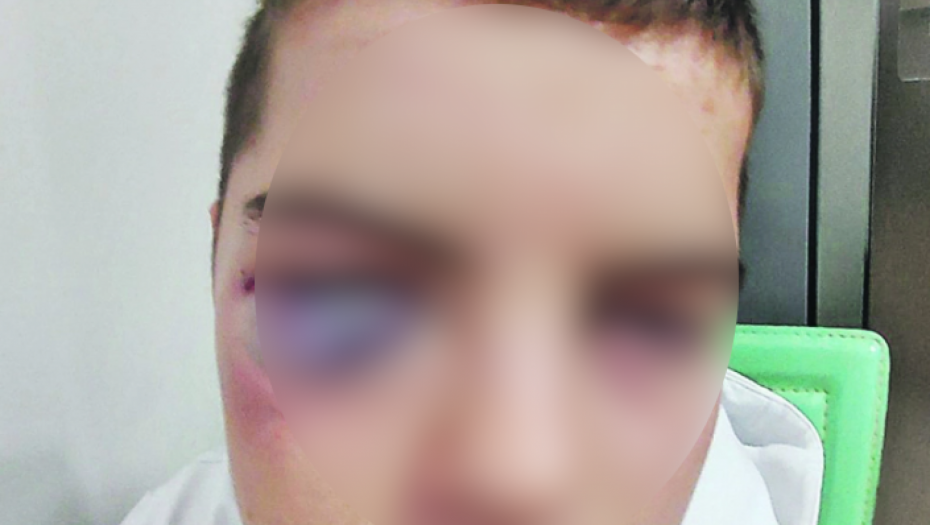 (UZNEMIRUJUĆE FOTOGRAFIJE) CRNI NIZ NASILJA S. S. (15) iz Vlasotinca krvnički pretukao vršnjak na košarkaškom treningu