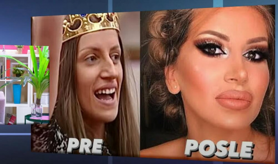 PLASTIČNI HIRURG RAZOTKRIO NAŠE POZNATE DAME: Evo šta se sve operisale, Dalila Dragojević promenila lični opis, ali nije jedina! TU SU I FOTKE!