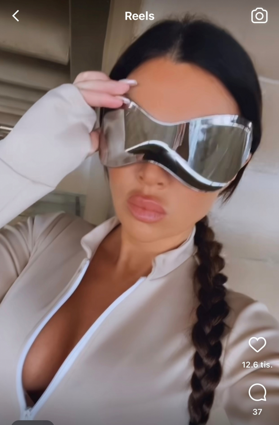 ŠTA SI TO URADILA S LICEM?! Stanija se izoperisala, ne liči na sebe! (FOTO)