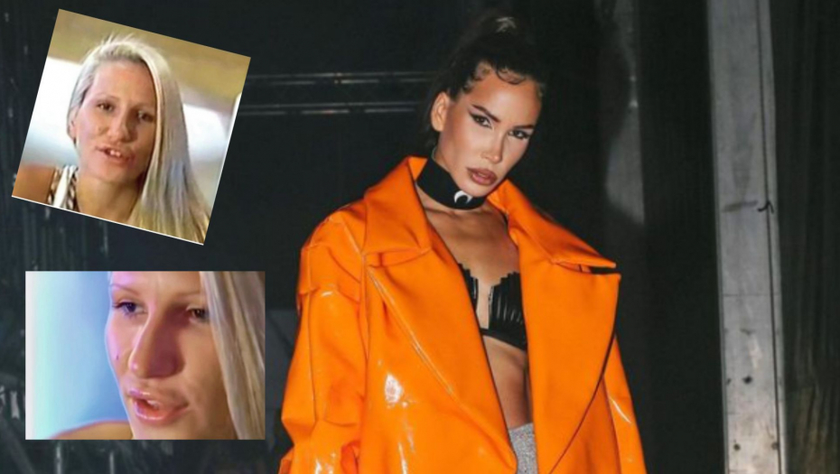 NEPREPOZNATLJIVA Danas je jedna od najatraktivnijih pevačica, EVO ŠTA JE SVE OPERISALA NIKOLIJA JOVANOVIĆ