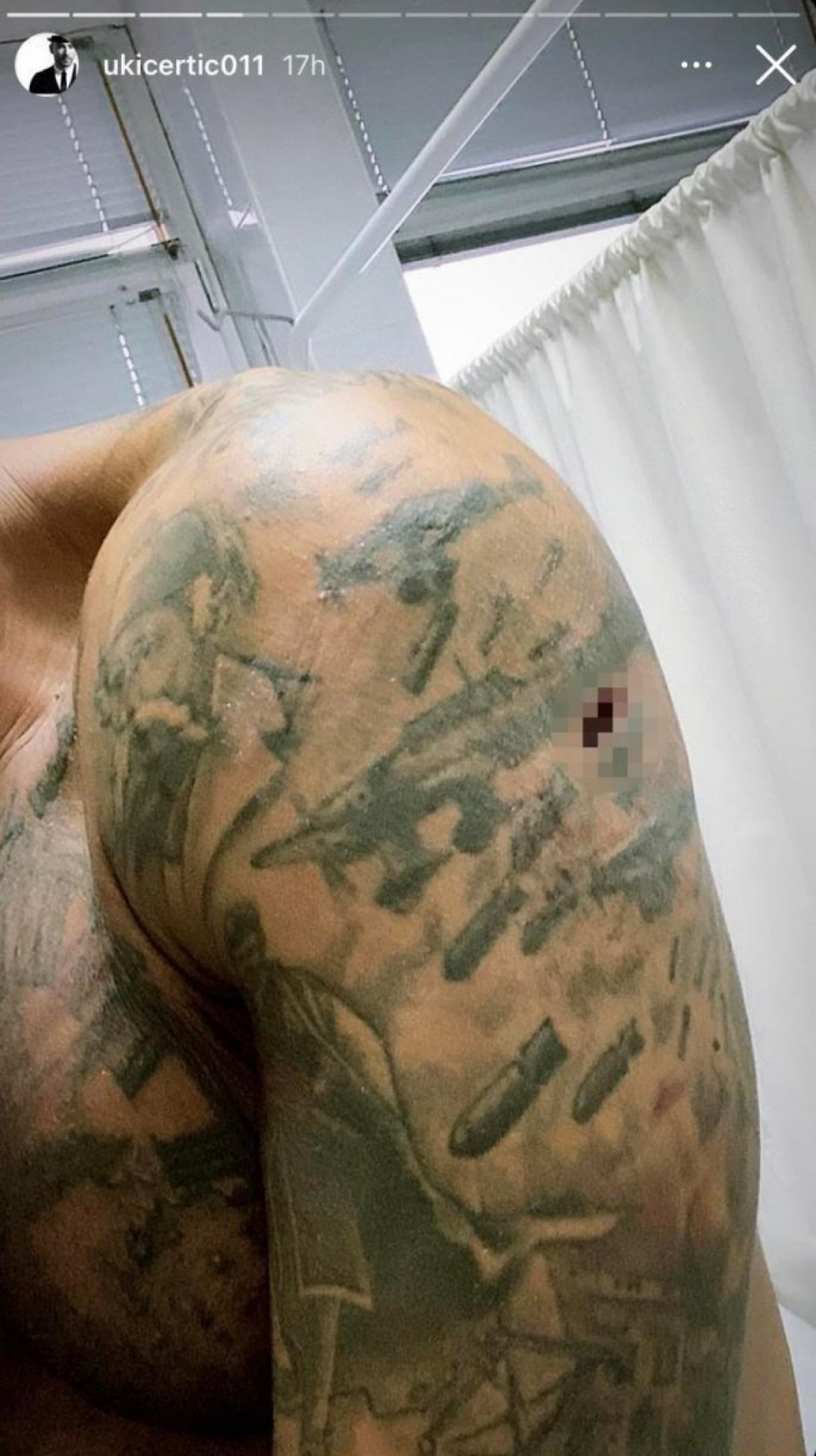 DISKVALIFIKOVANI ZADRUGAR HOSPITALIZOVAN Rane po telu, krvari, morao hitno da reaguje! (FOTO)