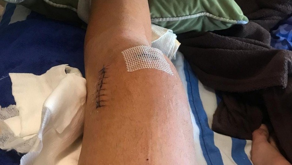 Bilal Brajlović povreda