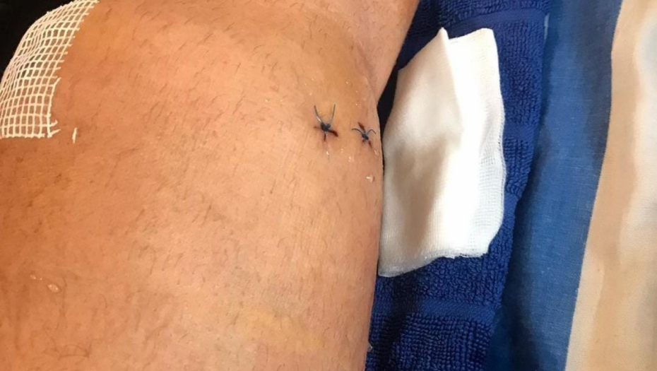 Bilal Brajlović povreda