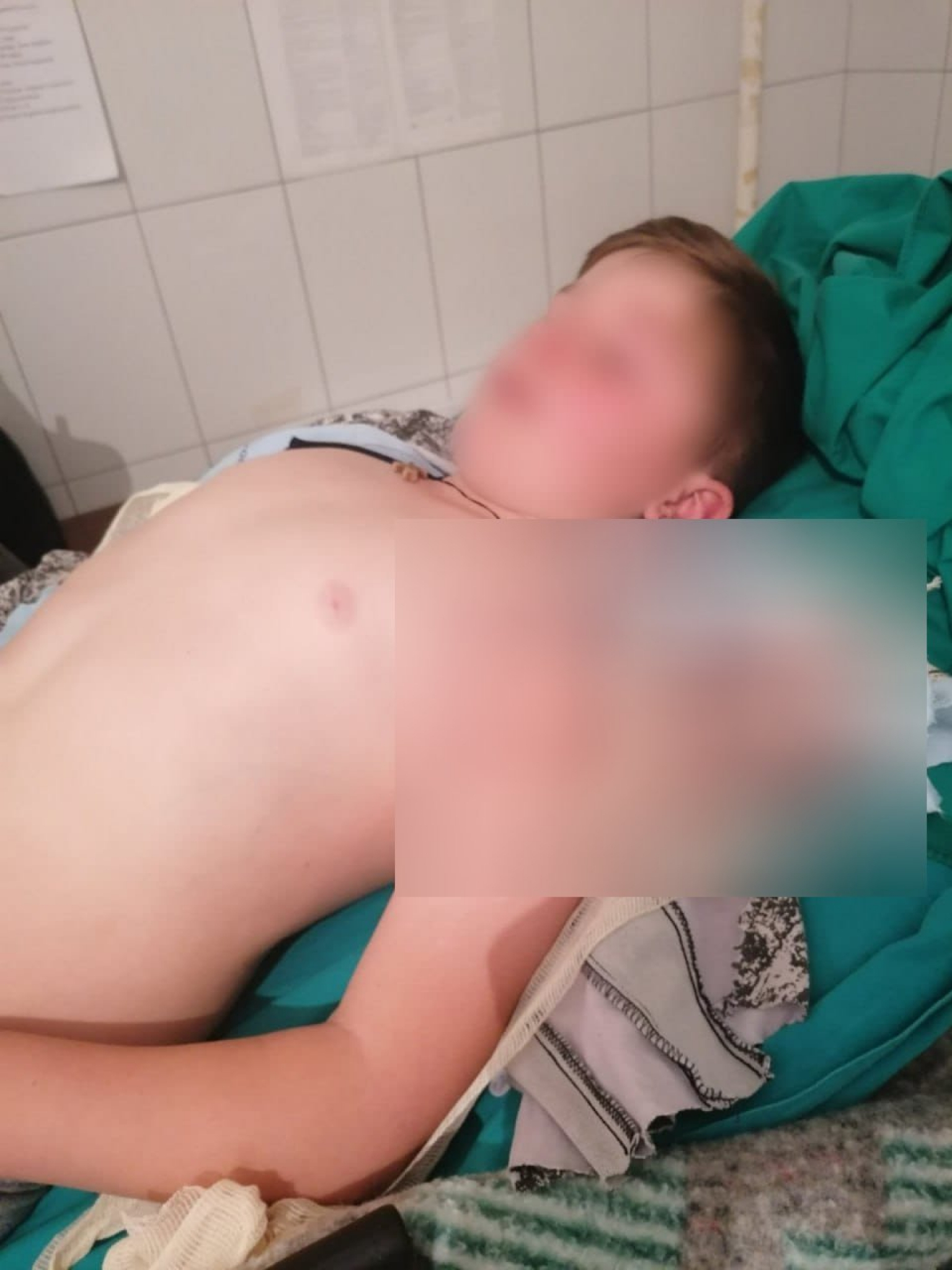 STRAVIČAN ZLOČIN NAD SRPSKOM DECOM Doktor otkrio u kakvom stanju je ranjeni 11-ogodišnjak u Štrpcu (UZNEMIRUJUĆA FOTOGRAFIJA)