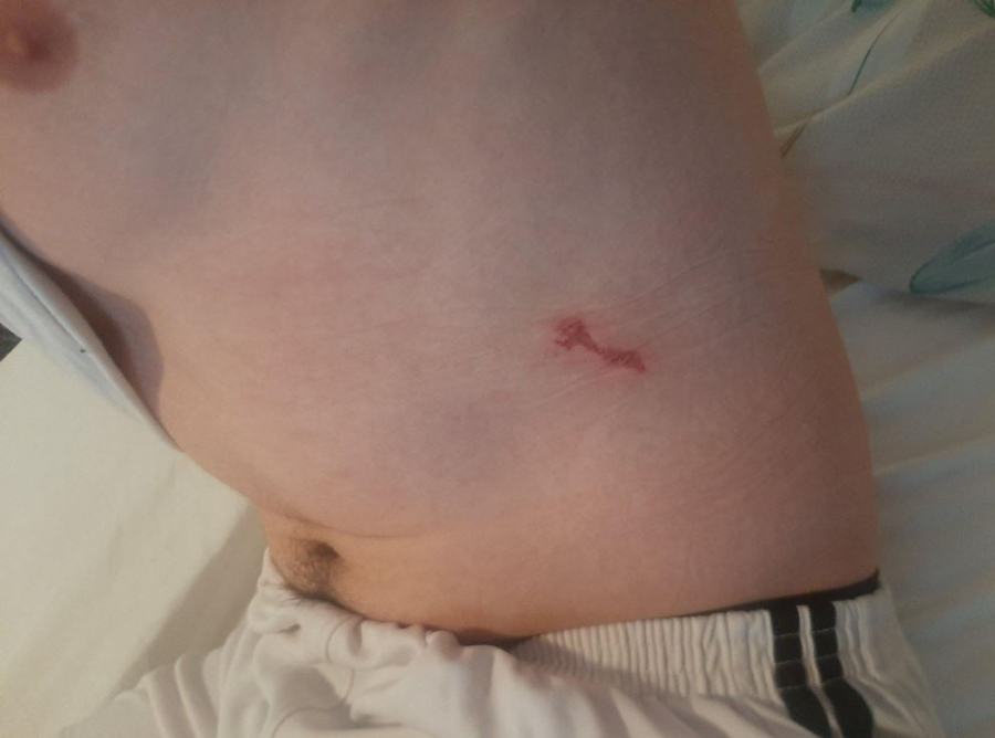 UŽASNI DETALJI NAPADA NA STEFANA! Šiptari ga zaskočili na ulici, a onda je počeo teror Kurtijeve policije!