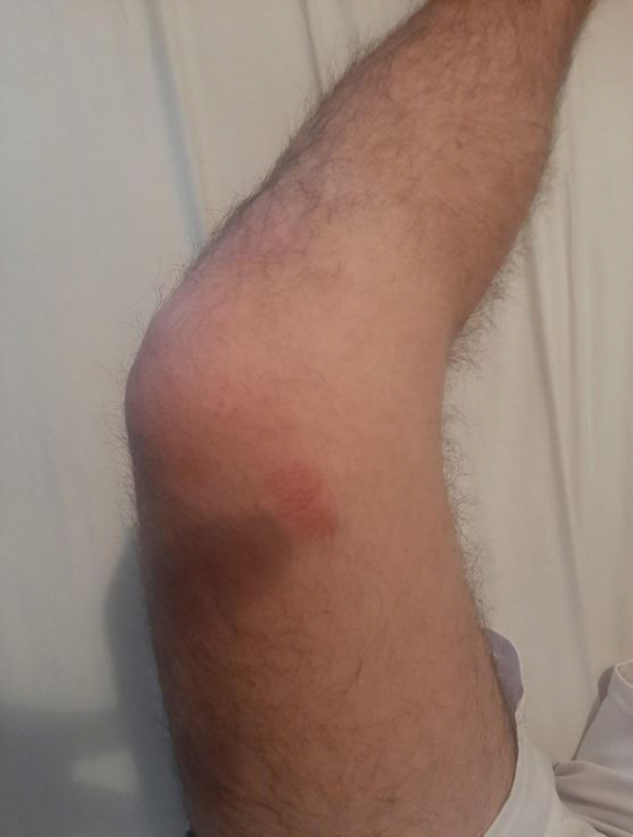 UŽASNI DETALJI NAPADA NA STEFANA! Šiptari ga zaskočili na ulici, a onda je počeo teror Kurtijeve policije!