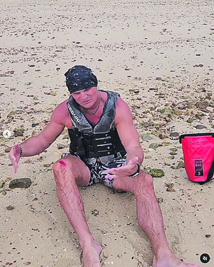 MALER NA ODMORU  Mili razbio koleno (FOTO)