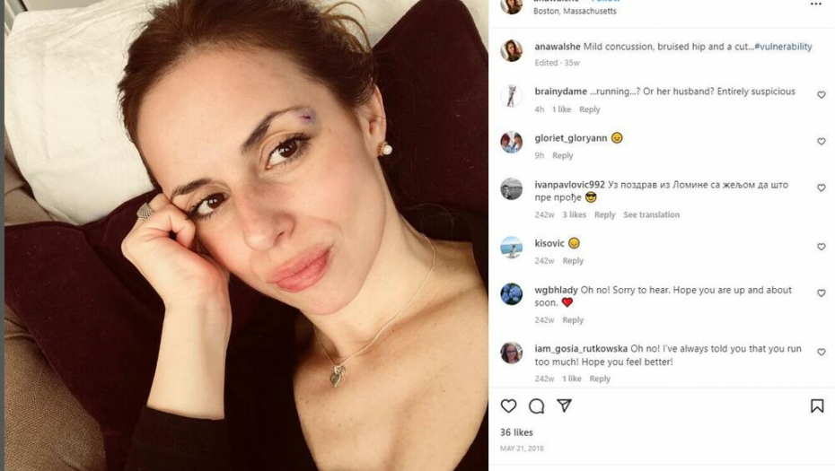 POTRES MOZGA I POCEPANA SLEPOOČNICA Objava Ane Volš na Instagramu ledi krv, da li ovo sve objašnjava?! (FOTO)