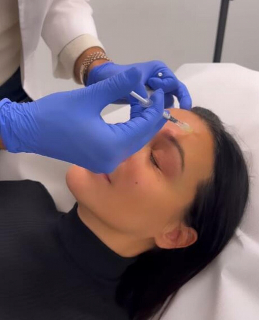 UBRIZGAVALI KRV U LICE Ovo su najbizarnije metode kojima se estrada podvrgla SVE ZA LEPOTU