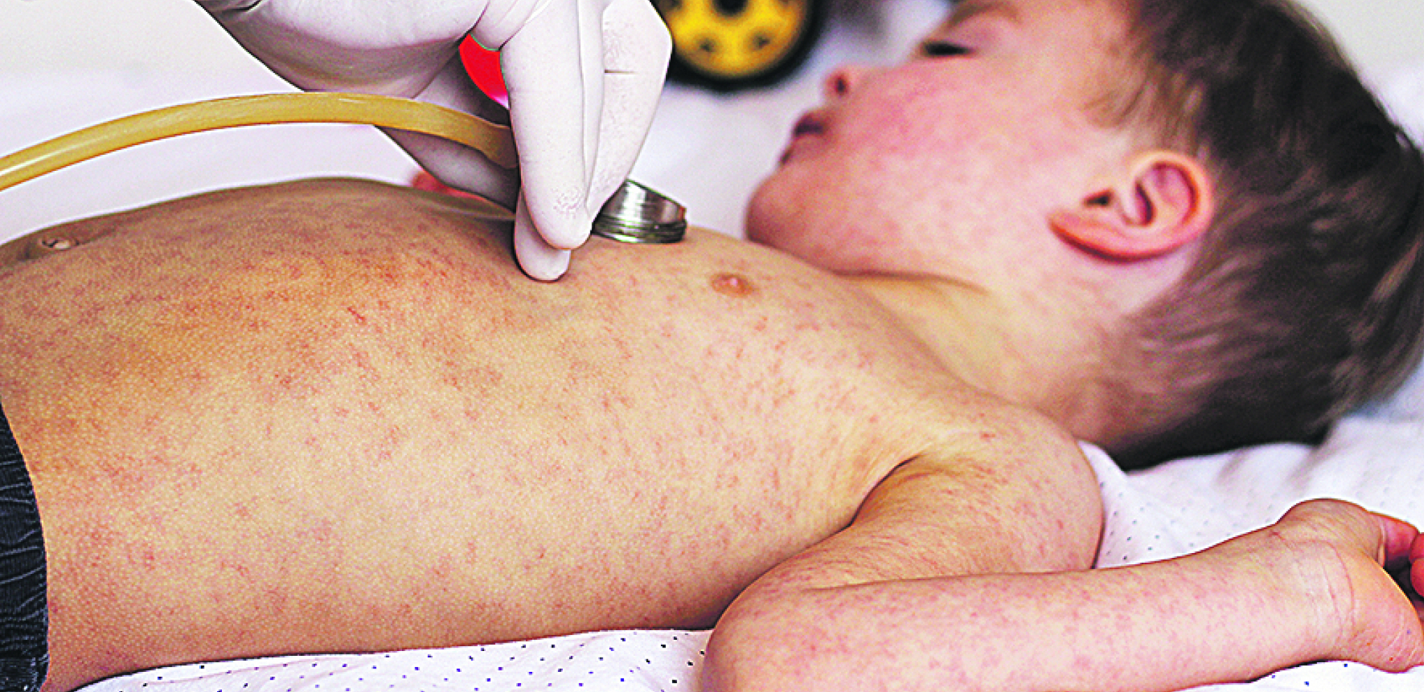 Male boginje se šire!