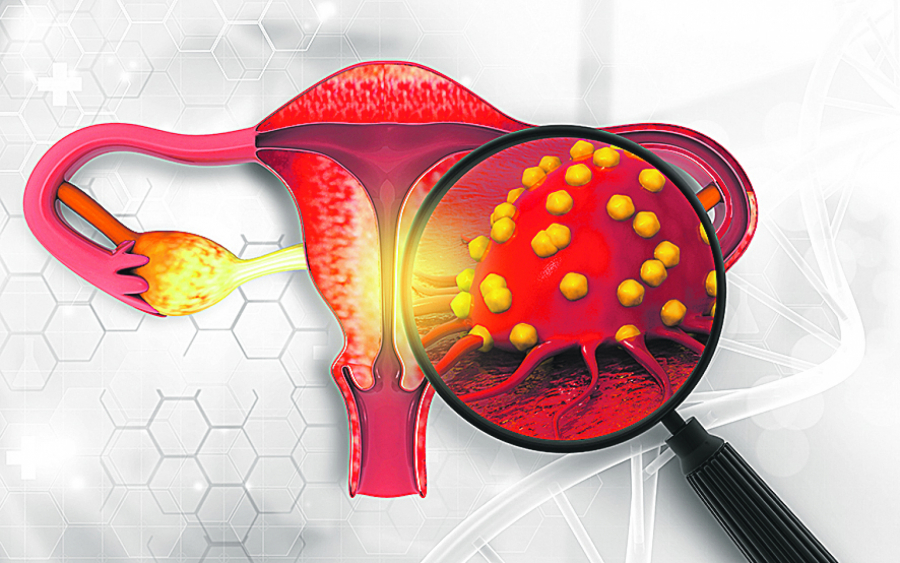 BOL U KIČMI MOŽE DA UKAŽE NA OPASNU BOLEST To je jedan od simptoma raka grlića materice