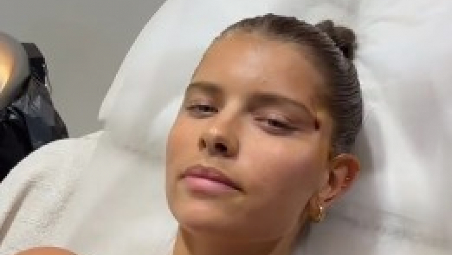 NA ŠTA SU ŽENE SPREMNE ZA SAVRŠEN IZGLED Kako izgleda tretman kojim se dobijaju "mačkaste" oči