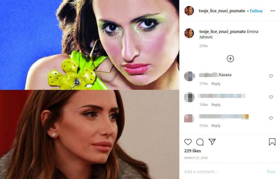 ŠOKANTNO KAKO JE EMINA JAHOVIĆ IZGLEDALA PRE SVIH OPERACIJA Zanemećete od prave istina, konačno vidimo njeno pravo lice! (FOTO)