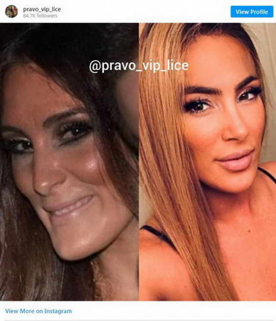 RASKRINKANO PRAVO LICE SENIDAH Evo kako je zapravo pevačica izgledala pre svih estetskih operacija, konačno se vidi prava slika (FOTO)